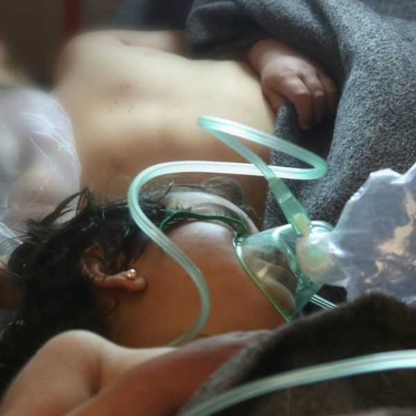 Un bambino siriano ricoverato dopo l'attacco con armi chimiche a Idlib