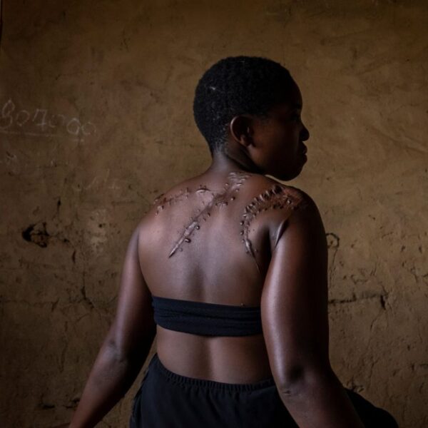 Georgette Ndovya Kavugho, 32 anni, posa per un ritratto il 6 aprile 2021 a Mbaou, Beni, Repubblica Democratica del Congo. Georgette Ndovya Kavugho è stata aggredita da membri del gruppo islamista ADF nella sua casa il 16 novembre 2019. L'hanno colpita con dei machete, lasciandole profonde ferite alle braccia e alla schiena, e l'hanno infine lasciata per morta mentre continuavano a saccheggiare il suo villaggio.